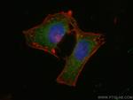 GNAS Antibody in Immunocytochemistry (ICC/IF)