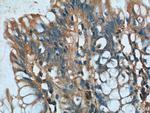 GNAS Antibody in Immunohistochemistry (Paraffin) (IHC (P))