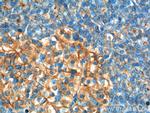 GNAS Antibody in Immunohistochemistry (Paraffin) (IHC (P))