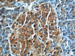 GNAS Antibody in Immunohistochemistry (Paraffin) (IHC (P))