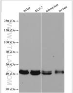 GNAS Antibody in Western Blot (WB)