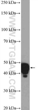 GNAS Antibody in Western Blot (WB)