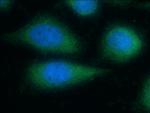 CDC42 Antibody in Immunocytochemistry (ICC/IF)