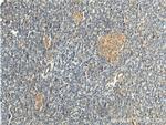 CDC42 Antibody in Immunohistochemistry (Paraffin) (IHC (P))