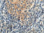 CDC42 Antibody in Immunohistochemistry (Paraffin) (IHC (P))