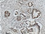 CDC42 Antibody in Immunohistochemistry (Paraffin) (IHC (P))