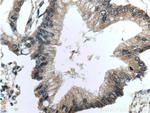 CDC42 Antibody in Immunohistochemistry (Paraffin) (IHC (P))