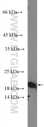 CDC42 Antibody in Western Blot (WB)