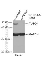 TUSC4 Antibody in Western Blot (WB)