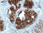 Cytokeratin 13 Antibody in Immunohistochemistry (Paraffin) (IHC (P))