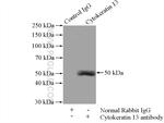 Cytokeratin 13 Antibody in Immunoprecipitation (IP)