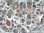 DOPA decarboxylase Antibody in Immunohistochemistry (Paraffin) (IHC (P))