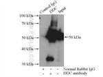 DOPA decarboxylase Antibody in Immunoprecipitation (IP)