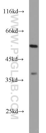 DOPA decarboxylase Antibody in Western Blot (WB)