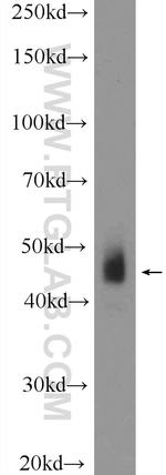 DOPA decarboxylase Antibody in Western Blot (WB)