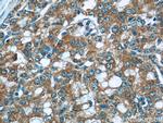 ACSM3 Antibody in Immunohistochemistry (Paraffin) (IHC (P))