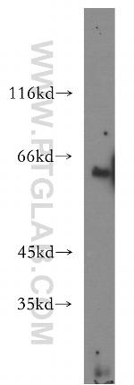 ACSM3 Antibody in Western Blot (WB)