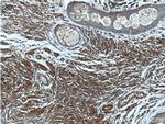 Beta Arrestin 2 Antibody in Immunohistochemistry (Paraffin) (IHC (P))