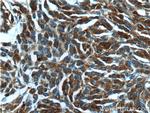 Beta Arrestin 2 Antibody in Immunohistochemistry (Paraffin) (IHC (P))