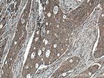 Beta Arrestin 2 Antibody in Immunohistochemistry (Paraffin) (IHC (P))