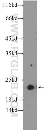 NKIRAS2 Antibody in Western Blot (WB)