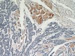 AKT Antibody in Immunohistochemistry (Paraffin) (IHC (P))