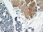 AKT Antibody in Immunohistochemistry (Paraffin) (IHC (P))