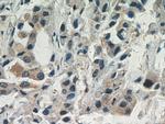 AKT Antibody in Immunohistochemistry (Paraffin) (IHC (P))