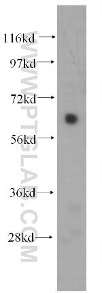 AKT Antibody in Western Blot (WB)