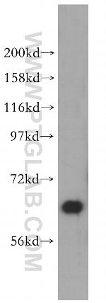 AKT Antibody in Western Blot (WB)