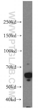 AKT Antibody in Western Blot (WB)