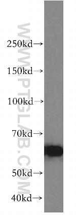 AKT Antibody in Western Blot (WB)