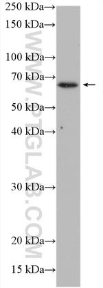 AKT Antibody in Western Blot (WB)