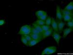 AKT Antibody in Immunocytochemistry (ICC/IF)