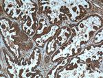 AKT Antibody in Immunohistochemistry (Paraffin) (IHC (P))