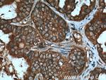 AKT Antibody in Immunohistochemistry (Paraffin) (IHC (P))