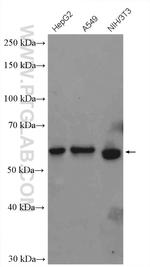 AKT Antibody in Western Blot (WB)