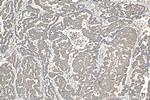 AKT Antibody in Immunohistochemistry (Paraffin) (IHC (P))