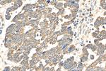 AKT Antibody in Immunohistochemistry (Paraffin) (IHC (P))