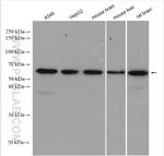 AKT Antibody in Western Blot (WB)