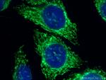 Mitofilin Antibody in Immunocytochemistry (ICC/IF)