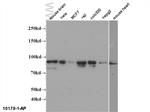 Mitofilin Antibody in Western Blot (WB)