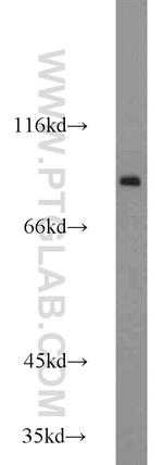 Mitofilin Antibody in Western Blot (WB)