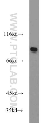 Mitofilin Antibody in Western Blot (WB)