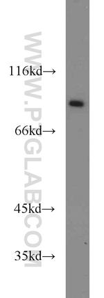 Mitofilin Antibody in Western Blot (WB)