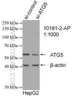 ATG5 Antibody in Western Blot (WB)