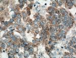 DCTN5 Antibody in Immunohistochemistry (Paraffin) (IHC (P))