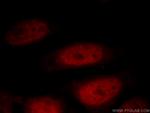 DIDO1 Antibody in Immunocytochemistry (ICC/IF)