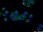 RAB6A Antibody in Immunocytochemistry (ICC/IF)