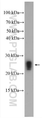 RAB6A Antibody in Western Blot (WB)